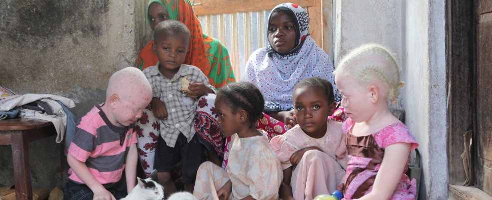 Family group sitting together. Son and daughter have Albinism.